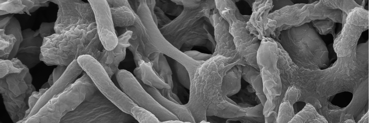 Biofilms on carbon steel close up